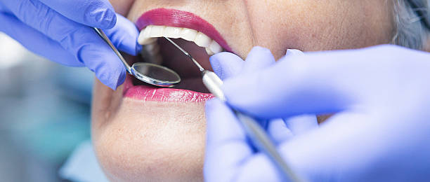 Best Emergency Dental Care for Broken or Chipped Teeth in Pompton Lakes, NJ